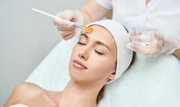 Cách chăm sóc sau peel da tại nhà
