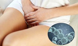 Nhiễm nấm Candida c&#243; g&#226;y v&#244; sinh kh&#244;ng?