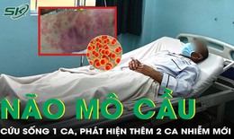 Cứu sống bệnh nhân mắc não mô cầu, khoanh vùng phát hiện thêm 2 ca mới
