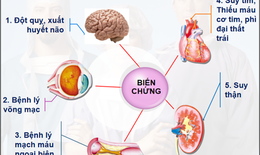 Đồng mắc đái tháo đường và tăng huyết áp, dùng thuốc như thế nào?