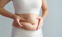 9 món ăn vặt hỗ trợ giảm mỡ bụng