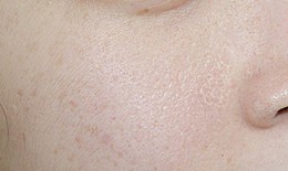 Các bước cấp ẩm cho da khô