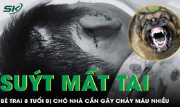 Bị chó nhà cắn, bé trai 8 tuổi suýt bị mất tai