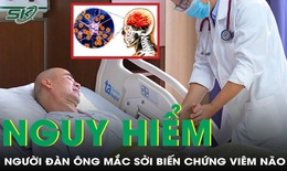 Người đ&#224;n &#244;ng 50 tuổi mắc sởi biến chứng vi&#234;m n&#227;o nguy kịch 
