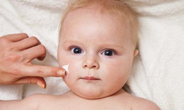 Thuốc điều trị bệnh vảy nến ở trẻ em