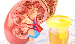 Đạm niệu: Nguyên nhân, biểu hiện, cách điều trị và phòng bệnh