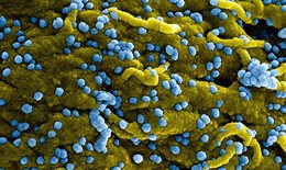 Tanzania tuy&#234;n bố kết th&#250;c đợt b&#249;ng ph&#225;t bệnh do virus Marburg thứ hai