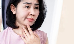 Chế độ dinh dưỡng chăm sóc người bị liệt mặt