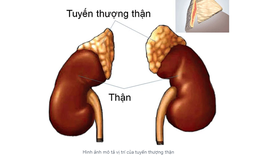 Suy tuyến thượng thận: Hiểu đúng để điều trị hiệu quả