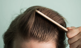 Kích thích mọc tóc bằng vitamin B1 dễ thực hiện tại nhà