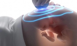 Hội chứng Noonan: Nguyên nhân, biểu hiện, cách điều trị và phòng bệnh