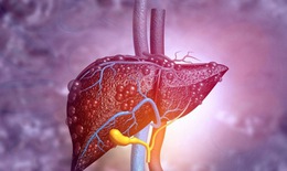 Việt Nam thuộc nh&#243;m 10 quốc gia c&#243; số ca vi&#234;m gan B v&#224; C cao nhất thế giới