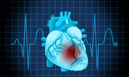 Dấu hiệu cảnh báo rối loạn nhịp tim