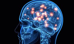 Hội chứng Tourette: Nguyên nhân, biểu hiện, cách điều trị và phòng bệnh