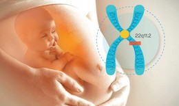 Hội chứng DiGeorge: Nguyên nhân, biểu hiện, cách điều trị và phòng bệnh