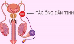 Các câu hỏi thường gặp về bệnh viêm tắc ống dẫn tinh