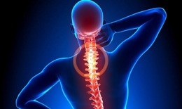 Hẹp ống sống: Nguy&#234;n nh&#226;n, biểu hiện, c&#225;ch điều trị v&#224; ph&#242;ng bệnh