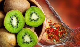 Dinh dưỡng an toàn cho người bệnh huyết khối (cục máu đông)