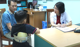 Câu hỏi thường gặp về gù cột sống