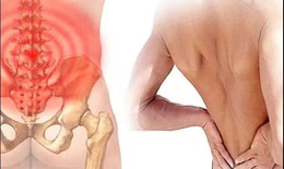 C&#226;u hỏi thường gặp li&#234;n quan đến ch&#232;n &#233;p d&#226;y thần kinh thẹn