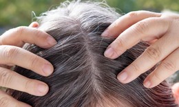 6 th&#243;i quen khiến t&#243;c bạc sớm