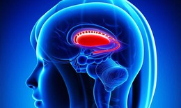 Hạch nền: Nguyên nhân, biểu hiện, cách điều trị và phòng bệnh