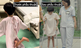 Sau 12 năm di chuyển bằng đầu gối, bé gái lần đầu được đi bằng chính đôi chân mình