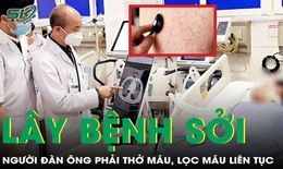 Người đàn ông ở Hà Nội phải thở máy, lọc máu liên tục vì lây sởi từ đồng nghiệp