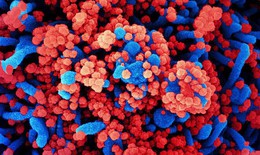 Nga lên tiếng về loại virus chưa xác định gây ra tình trạng ho ra máu