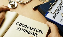 6 câu hỏi thường gặp về hội chứng Goodpasture