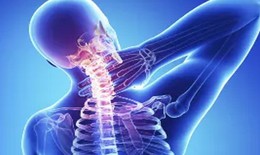 Các thuốc điều trị Hội chứng đầu cổ