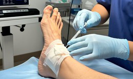 C&#225;c thuốc d&#249;ng trị Hội chứng ống cổ ch&#226;n