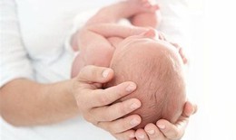 C&#226;u hỏi thường gặp li&#234;n quan đến hội chứng Crouzon