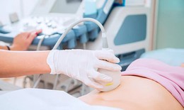 Câu hỏi thường gặp liên quan đến hội chứng Mittelschmerz