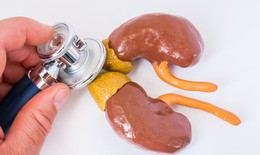 Câu hỏi thường gặp liên quan đến hội chứng Cushing