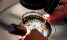 Lần đầu ph&#225;t hiện vi nhựa trong dịch nang buồng trứng người