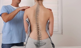 Vẹo cột sống: Nguy&#234;n nh&#226;n, triệu chứng, ph&#242;ng ngừa v&#224; điều trị