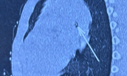 Bé trai 7 tuổi thở ra...tiếng kèn