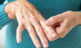 Người bệnh viêm khớp dạng thấp có nên tập thể dục?