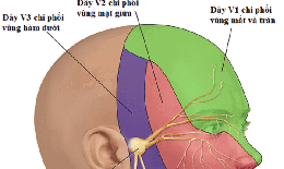 Câu hỏi thường gặp liên quan đến bệnh đau dây thần kinh sinh ba