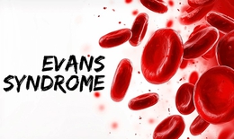 6 c&#226;u hỏi thường gặp về hội chứng Evans