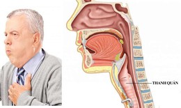 Liệt cơ mở thanh quản: Nguyên nhân, biểu hiện, cách điều trị và phòng bệnh