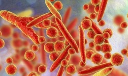 WHO bác thông tin về virus lạ gây triệu chứng ho ra máu ở Nga