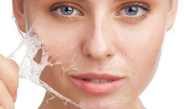 Ưu điểm và rủi ro khi peel da
