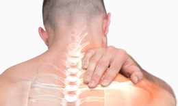6 câu hỏi thường gặp về hội chứng đầu cổ