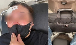 Một phụ nữ bị đánh giữa phố vì dừng xe nghe điện thoại