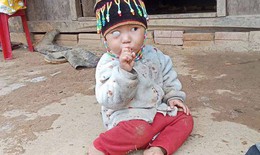 B&#233; 2 tuổi bị ung thư v&#245;ng mạc, cha mẹ ngh&#232;o b&#225;n đ&#224;n lợn cũng kh&#244;ng đủ tiền chữa trị