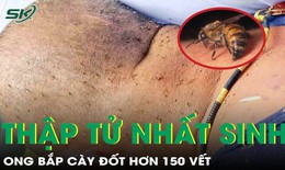 Ong đốt hơn 150 vết, người đàn ông thập tử nhất sinh
