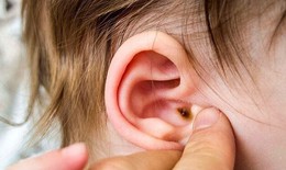 Biến chứng viêm tai giữa ở trẻ nguy hiểm hơn bạn tưởng