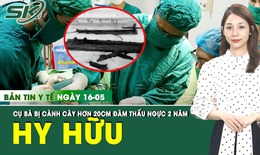 Bản Tin Y Tế 16/5: Cụ bà bị cành cây dài hơn 20cm đâm thấu ngực hơn 2 năm không hề biết